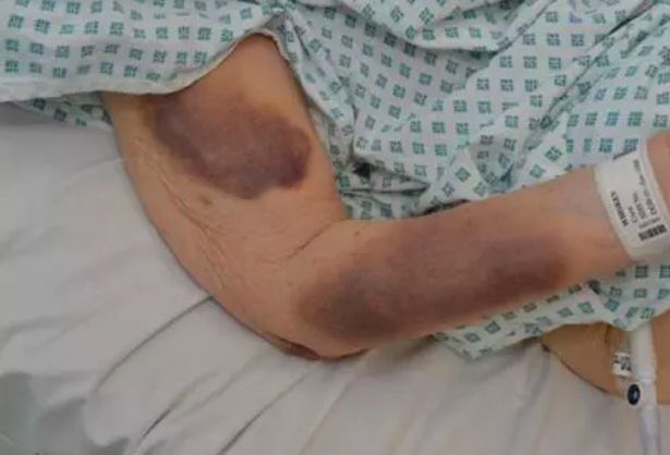 Iris Warner picchiata da uno sconosciuto