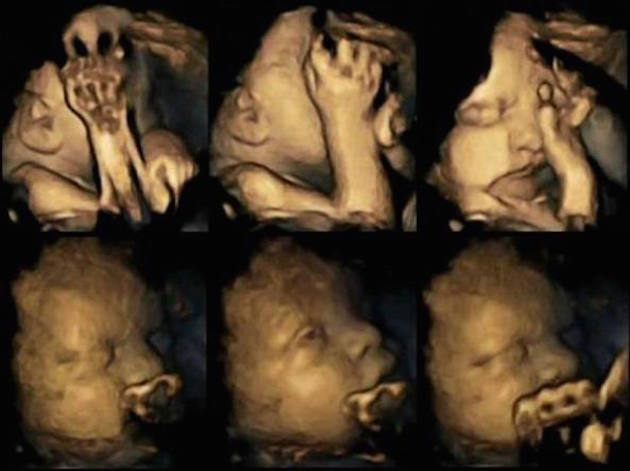 Gli effetti del fumo sul feto