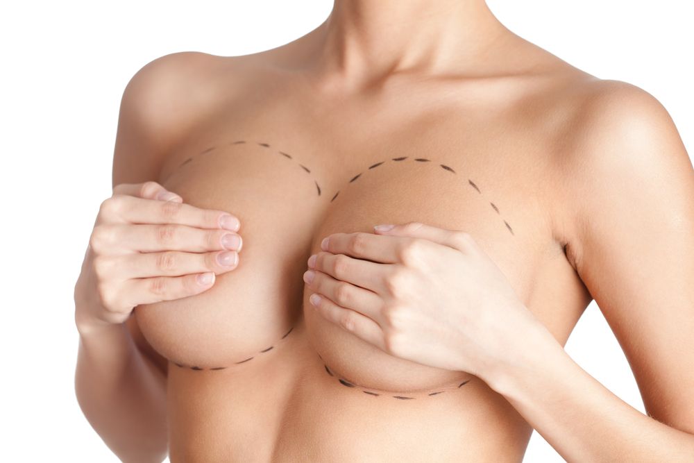 Arrivano in Italia le protesi “spaziali” per il seno