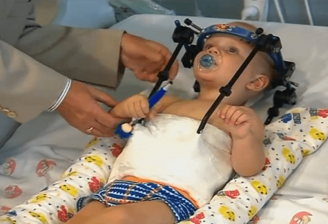 Riattaccata la testa a bimbo di 16 mesi decapitato in incidente: intervento chirurgico miracoloso