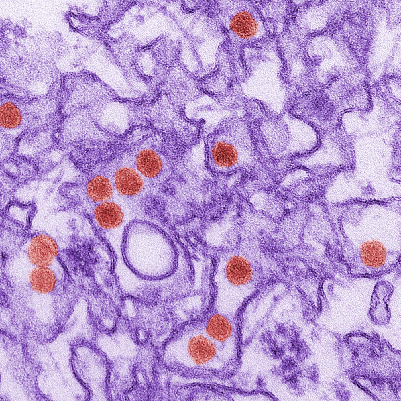 Il virus Zika causa microcefalia, la conferma arriva dagli USA