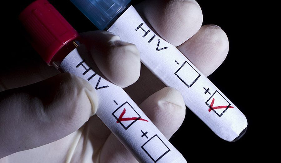 hiv farmacia test