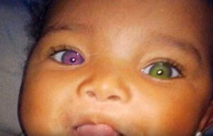 I 10 Bambini Con Un Colore Degli Occhi Unico Al Mondo