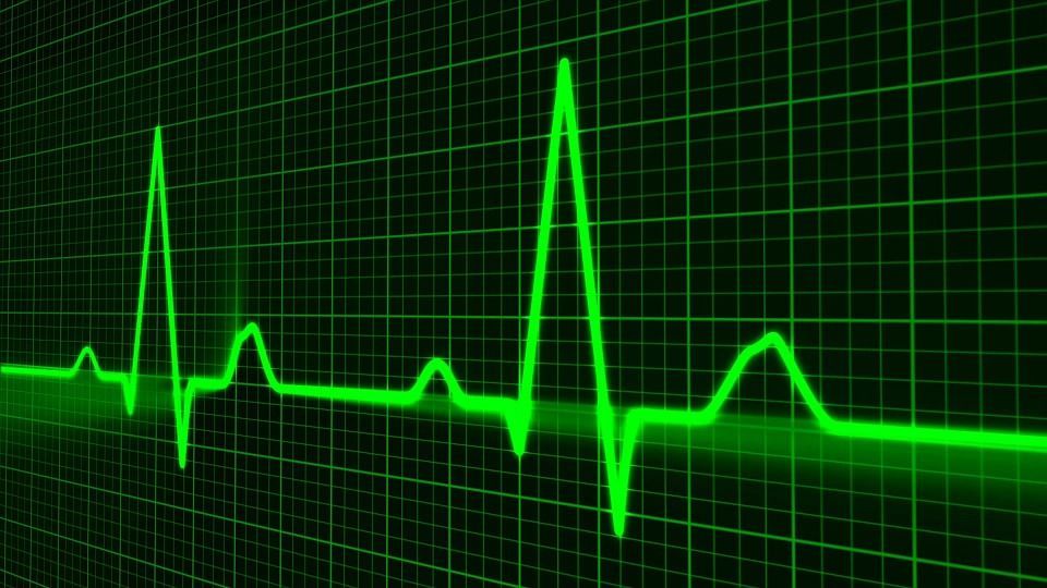 Infarto cardiaco: le cause che favoriscono la morte del miocardio