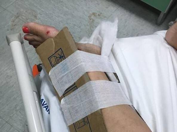 Reggio Calabria in ospedale mancano i gessi pazienti medicati con tutori di cartone