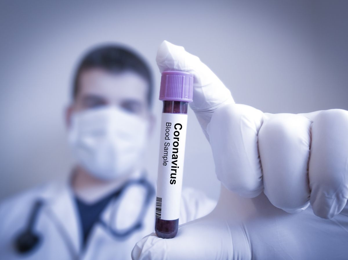 Vaccino Coronavirus: l’AIFA dice sì al farmaco italiano
