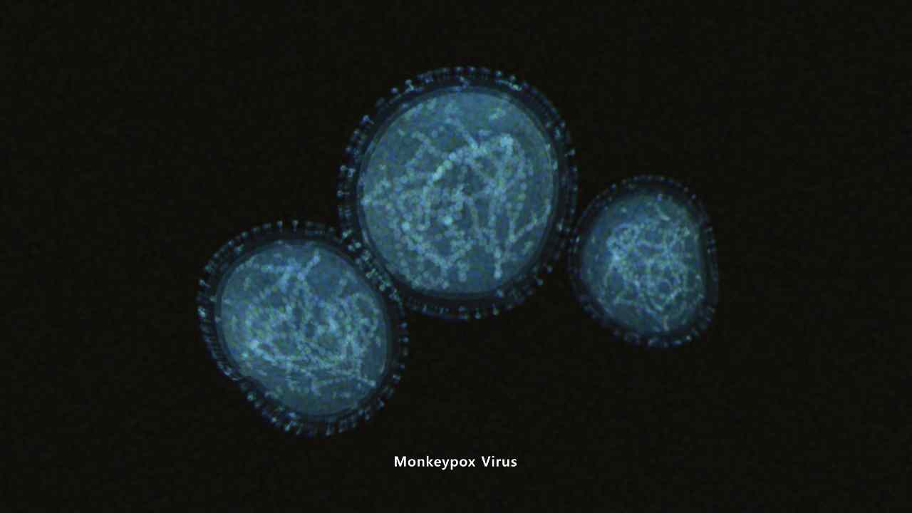 Virus Monkeypox