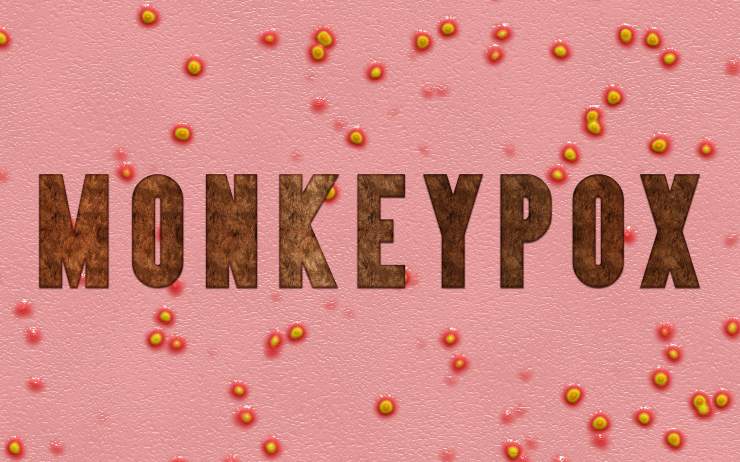 monkeypox