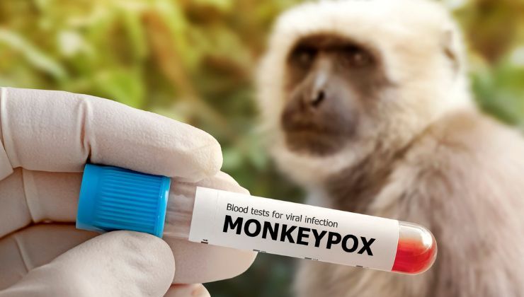 Test effettuato per il Vaiolo delle Scimmie