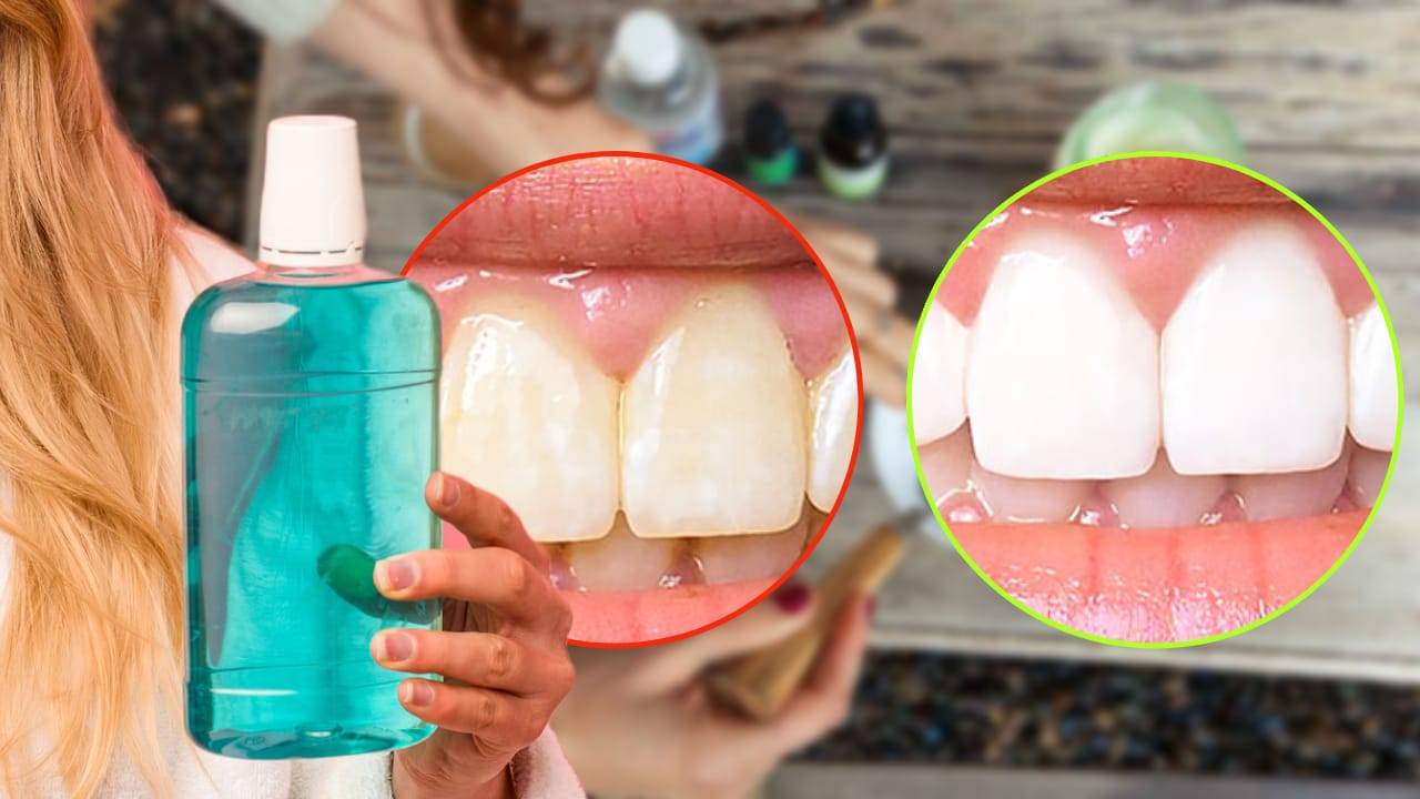 collutorio fai da te