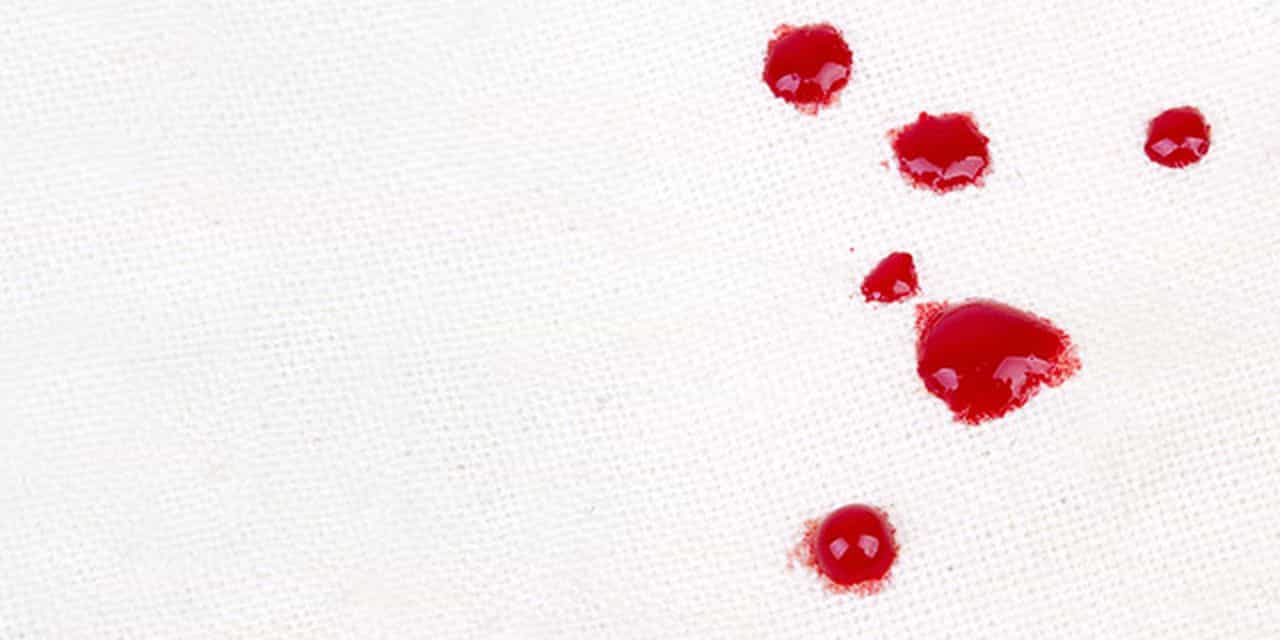eliminare sangue lenzuola