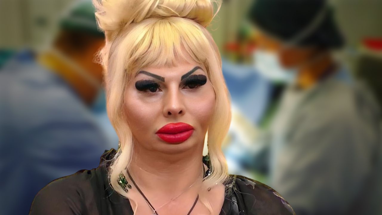 Elenoire Ferruzzi cifre chirurgia