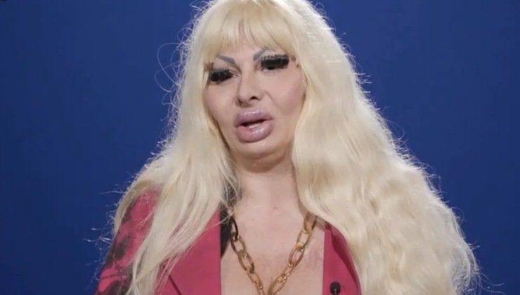 Elenoire Ferruzzi: ecco quanto ha speso per i suoi interventi