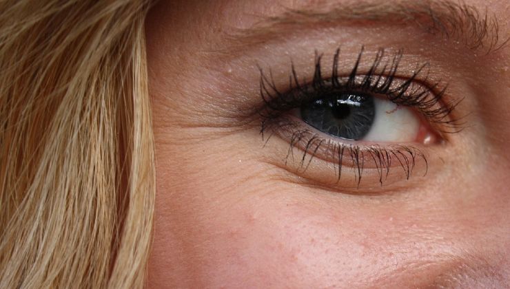 rughe sotto gli occhi 