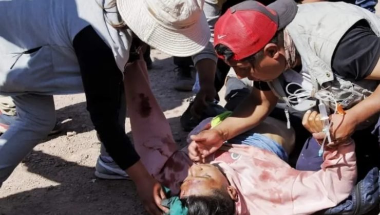 Feriti durante gli scontri peruviani 