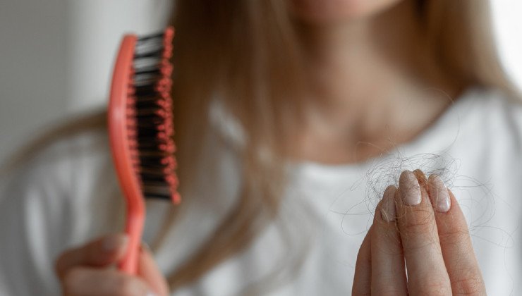 Caduta dei capelli 