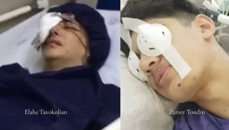 Giovani in Iran feriti agli occhi