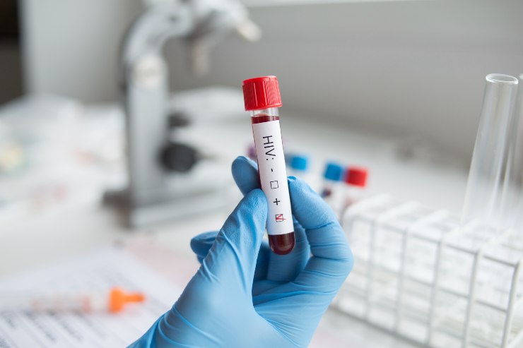 provetta con sangue per test HIV