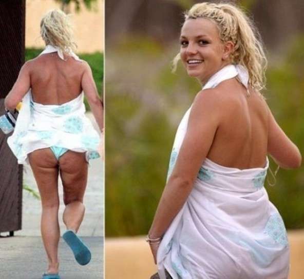 Cellulite per Britney Spears