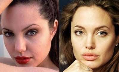 Angelina Jolie: rinoplastica